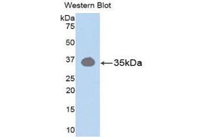 Western Blotting (WB) image for anti-Protein Kinase C, beta 1 (Pkc beta 1) (AA 342-600) antibody (ABIN1174155) (Pkc beta 1 Antikörper  (AA 342-600))