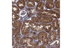 Immunohistochemical staining of human kidney with CNTN5 polyclonal antibody  shows strong cytoplasmic positivity in tubular cells at 1:50-1:200 dilution. (Contactin 5 Antikörper)