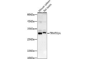 TRMT61A Antikörper  (AA 1-289)