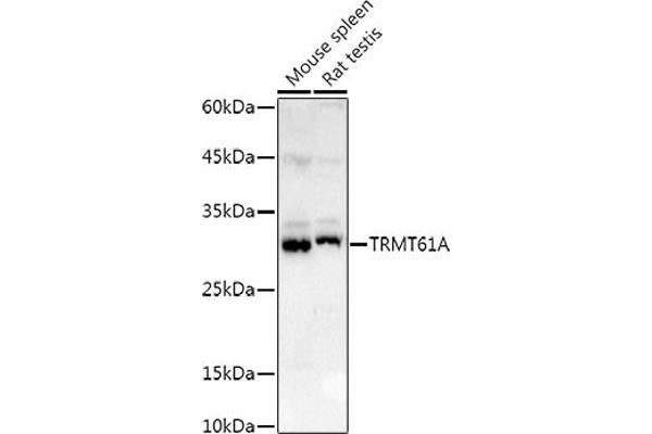 TRMT61A Antikörper  (AA 1-289)