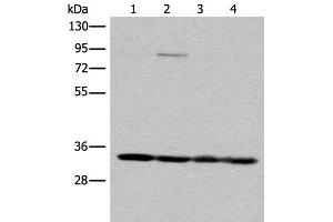 Western blot analysis of K562 HEPG2 231 and Jurkat cell lysates using MRPL1 Polyclonal Antibody at dilution of 1:350 (MRPL1 Antikörper)