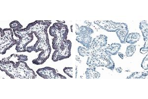 Immunohistochemistry (IHC) image for anti-Receptor Tyrosine-Protein Kinase ErbB-3 (ERBB3) antibody (ABIN967437) (ERBB3 Antikörper)
