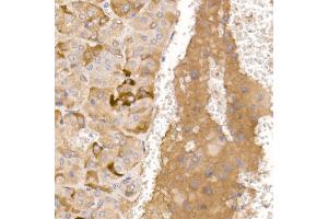 Immunohistochemistry of paraffin-embedded mouse adrenal gland using AGRP Rabbit pAb (ABIN7265515) at dilution of 1:50 (40x lens). (AGRP Antikörper  (AA 21-132))