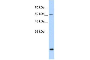 WB Suggested Anti-FUS Antibody Titration:  0. (FUS Antikörper  (N-Term))