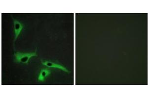 Immunofluorescence analysis of HeLa cells, using TSPAN8 antibody. (Tspan-8 Antikörper  (Internal Region))