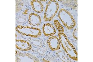 Immunohistochemistry of paraffin-embedded human kidney using OLR1 Antibody. (OLR1 Antikörper)