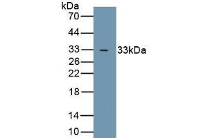 Detection of Recombinant GSK3b, Human using Polyclonal Antibody to Glycogen Synthase Kinase 3 Beta (GSK3b) (GSK3 beta Antikörper  (AA 122-375))