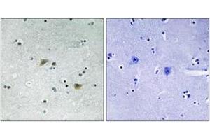 Immunohistochemistry analysis of paraffin-embedded human brain, using Src (Phospho-Ser75) Antibody. (Src Antikörper  (pSer75))