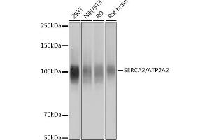 Western blot analysis of extracts of various cell lines, using SERC/ Rabbit mAb (ABIN7265753) at 1:1000 dilution. (ATP2A2 Antikörper)