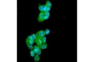 IF analysis of Ataxin 1 using anti-Ataxin 1 antibody (ABIN3043506).