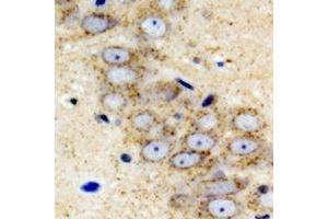 Immunohistochemical analysis of IGFBP5 staining in mouse brain formalin fixed paraffin embedded tissue section. (IGFBP5 Antikörper)