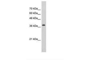 Image no. 1 for anti-Chromobox Homolog 6 (CBX6) (AA 321-370) antibody (ABIN202466) (CBX6 Antikörper  (AA 321-370))