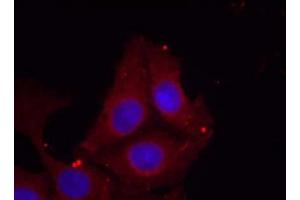 Immunofluorescence staining of methanol-fixed HeLa cells using GAP43 (Phospho-Ser41) Antibody (E011281, Red) (GAP43 Antikörper  (pSer41))