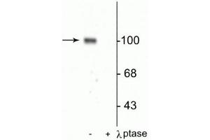 Western blot of rat hippocampal lysate showing specific immunolabeling of the ~100 kDa GluR1 protein phosphorylated at Ser845 in the first lane (-). (Glutamate Receptor 1 Antikörper  (pSer845))