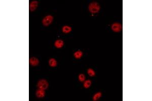 ABIN6274685 staining COLO205 by IF/ICC. (TCEB3C Antikörper  (Internal Region))