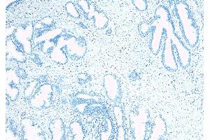 ABIN334520 Negative Control showing staining of paraffin embedded Human Prostate, with no primary antibody. (TUSC3 Antikörper  (Internal Region))