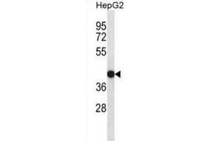 Western Blotting (WB) image for anti-Epidermal Retinal Dehydrogenase 2 (RDHE2) antibody (ABIN2998329) (SDR16C5 Antikörper)