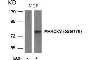 Western blot analysis of extracts from MCF cells untreated or treated with EGF using MARCKS(phospho-Ser170) Antibody. (MARCKS Antikörper  (pSer170))