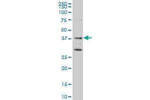 DNAJB2 monoclonal antibody (M02), clone 1B7. (DNAJB2 Antikörper  (AA 216-324))