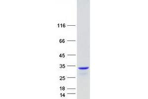 Western Blotting (WB) image for Exosome Component 5 (EXOSC5) protein (Myc-DYKDDDDK Tag) (ABIN2720626)
