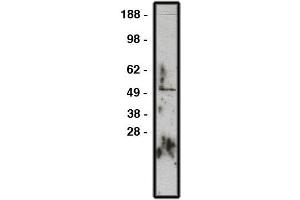 Western blot using GLI1 antibody , used  at 1:200k dilution. (GLI1 Antikörper)