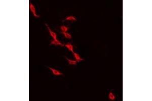 ABIN6274238 staining NIH-3T3 by IF/ICC. (Recoverin Antikörper  (Internal Region))