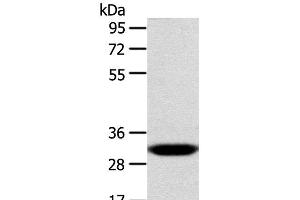 Western Blot analysis of Human fetal liver tissue using CCS Polyclonal Antibody at dilution of 1:300 (Superoxide dismutase copper chaperone Antikörper)