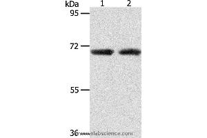 Western blot analysis of Human liver cancer and fetal kidney tissue, using ACOT11 Polyclonal Antibody at dilution of 1:650 (ACOT11 Antikörper)