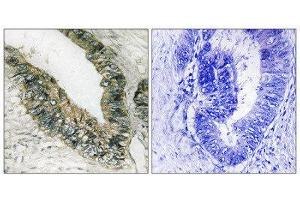 Immunohistochemistry (IHC) image for anti-Eukaryotic Translation Initiation Factor 2-alpha Kinase 3 (EIF2AK3) (Thr981) antibody (ABIN1848259) (PERK Antikörper  (Thr981))