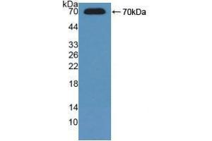 Western blot analysis of recombinant Mouse ADK. (ADK Antikörper  (AA 1-361))