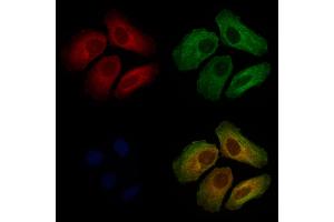 ABIN7093938 and ABIN7097982 staining Hela cells by IF/ICC. (OSBPL2 Antikörper  (C-Term))