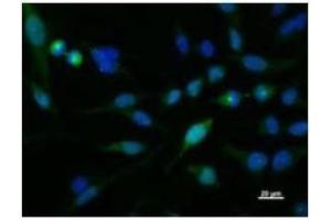 Immunostaining analysis in HeLa cells. (KIF2C Antikörper)