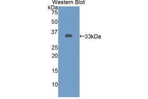 Western blot analysis of the recombinant protein. (ECE1 Antikörper  (AA 469-721))
