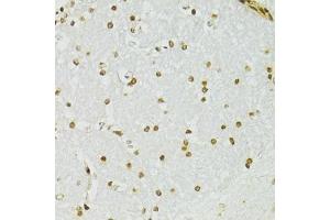 Immunohistochemistry (Paraffin-embedded Sections) (IHC (p)) image for anti-Adenosine Deaminase, RNA-Specific (ADAR) (AA 150-250) antibody (ABIN6136553)