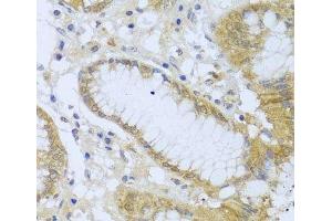 Immunohistochemistry of paraffin-embedded Human stomach using ACP1 Polyclonal Antibody at dilution of 1:100 (40x lens). (ACP1 Antikörper)