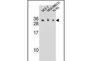 C1QL4 Antibody (N-term) (ABIN655459 and ABIN2844988) western blot analysis in MCF-7,MDA-M,HL-60 cell line lysates (35 μg/lane). (C1QL4 Antikörper  (N-Term))