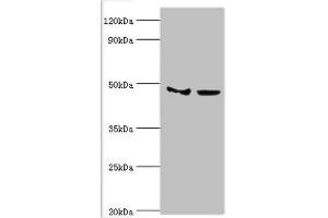 Western blot All lanes: Histone-lysine N-methyltransferase SMYD3 antibody at 3 μg/mL Lane 1: Hela whole cell lysate Lane 2: HepG2 whole cell lysate Secondary Goat polyclonal to rabbit IgG at 1/10000 dilution Predicted band size: 50, 30, 43 kDa Observed band size: 50 kDa (SMYD3 Antikörper  (AA 199-428))