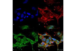 Immunocytochemistry/Immunofluorescence analysis using Mouse Anti-Clcn3 Monoclonal Antibody, Clone S258-5 . (CLCN3 Antikörper  (AA 98-115) (HRP))