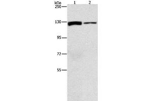 Western Blot analysis of A172 and PC3 cell using ACLY Polyclonal Antibody at dilution of 1:1050 (ACLY Antikörper)