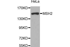 Western blot analysis of extracts of HeLa cell line, using MSH2 antibody. (MSH2 Antikörper)