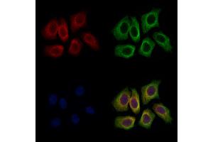 ABIN7094730 and ABIN7098781 staining Hela cells by IF/ICC.