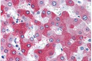 Human Liver (formalin-fixed, paraffin-embedded) stained with FTCD antibody ABIN351476 at 3. (FTCD Antikörper  (AA 2-17))