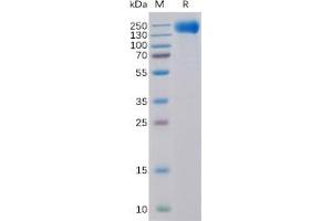 Human EGFR Protein, His Tag on SDS-PAGE under reducing condition. (EGFR Protein (His tag))