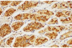 Immunohistochemistry of paraffin-embedded Human stomach using ST14 Ployclonal Antibody at dilution of 1:100. (ST14 Antikörper)