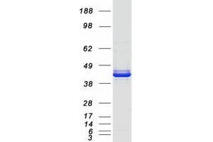 Western Blotting (WB) image for serpin Peptidase Inhibitor, Clade B (Ovalbumin), Member 3 (SERPINB3) protein (Myc-DYKDDDDK Tag) (ABIN2731797)