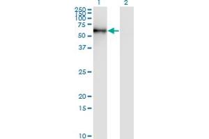 Western Blot analysis of STK33 expression in transfected 293T cell line by STK33 monoclonal antibody (M06), clone 4F7.