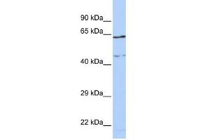 WB Suggested Anti-CCDC74A Antibody Titration: 0. (CCDC74A Antikörper  (Middle Region))