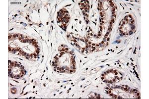 Immunohistochemical staining of paraffin-embedded breast using anti-NTF4 (ABIN2452547) mouse monoclonal antibody. (Neurotrophin 4 Antikörper  (AA 81-210))