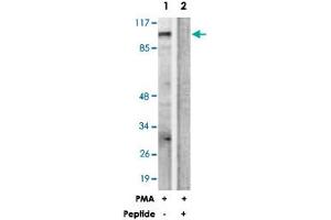 Western blot analysis of extracts from HUVEC cells, treated with PMA (125 ng/mL, 30 mins), using PRKD1 polyclonal antibody . (PKC mu Antikörper  (Ser205))