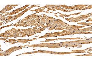 Detection of SOD1 in Mouse Cardiac Muscle Tissue using Polyclonal Antibody to Superoxide Dismutase 1 (SOD1) (SOD1 Antikörper  (AA 2-154))